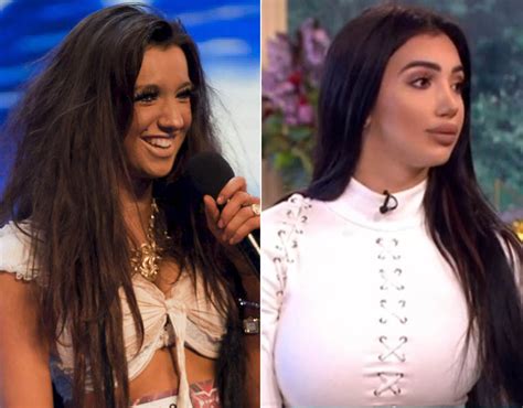 chloe khan|chloe khan before and after.